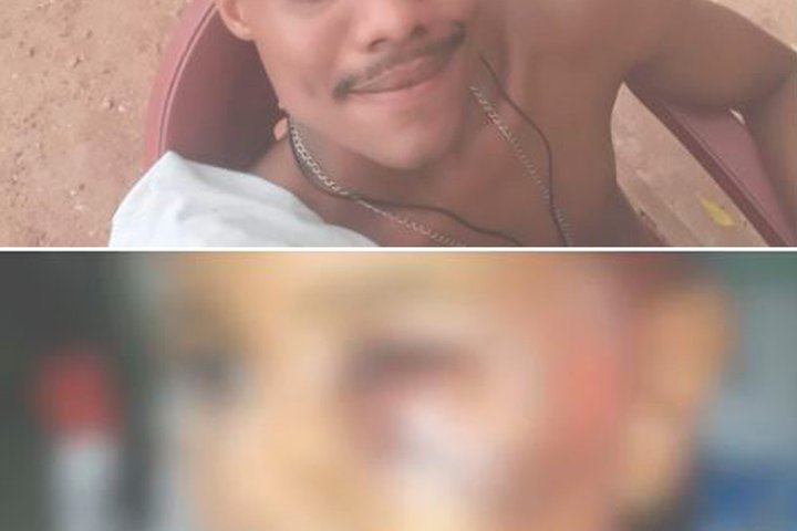 Imagem Menino de 4 anos é espancado e tem braço quebrado por Padrasto