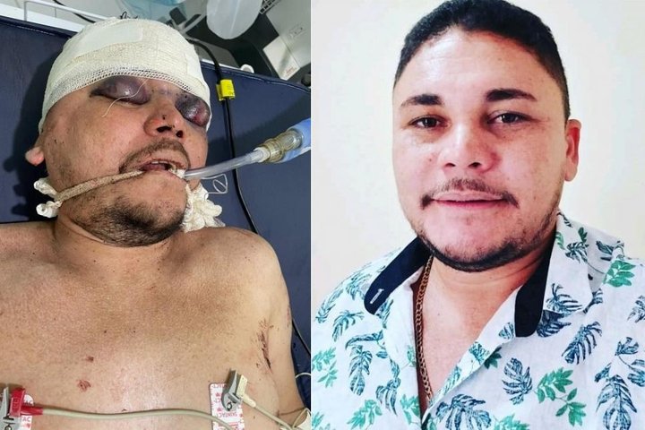 Imagem Altoense é encontrado ferido com dez tiros em Tanque do Piauí