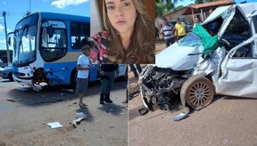 Imagem Após alguma cirurgias, mulher passa bem depois de grave acidente em Altos