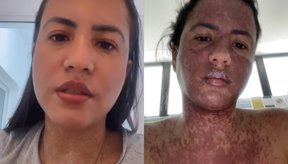 Imagem Mulher de Frank Aguiar relata internação na UTI com doença rara