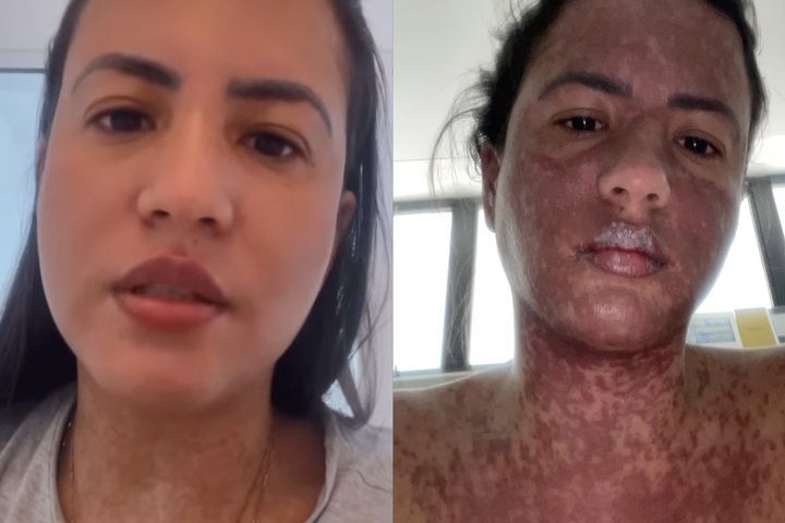 Imagem Mulher de Frank Aguiar relata internação na UTI com doença rara