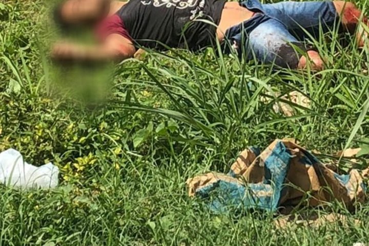 Imagem Homem mata assaltante, mas inocente também é baleado na cabeça, em Altos