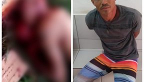 Imagem Homem é morto com vários tiros na cabeça, em Altos